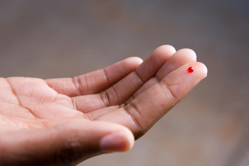 Thời điểm nào phù hợp để tiến hành xét nghiệm máu HIV
