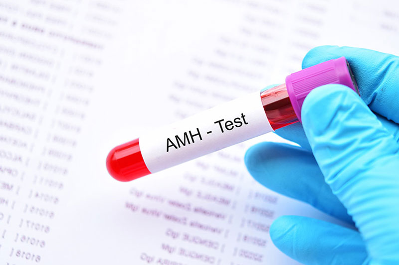 AMH là một loại glycoprotein dimer