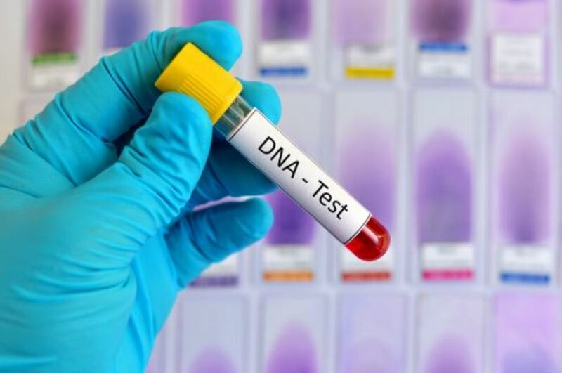 Xét nghiệm ADN hay còn gọi là xét nghiệm DNA