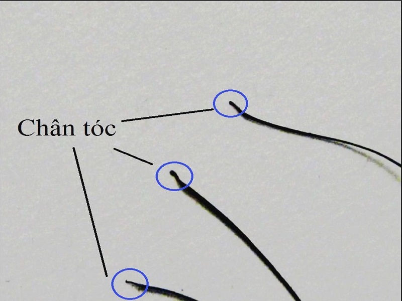 Mẫu xét nghiệm ADN là tóc/lông/râu thì buộc phải có chân nang 