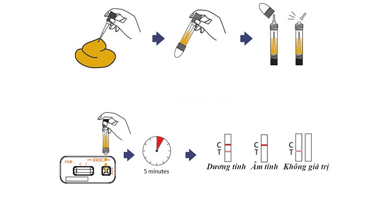 Quy trình xét nghiệm máu ẩn trong phân.