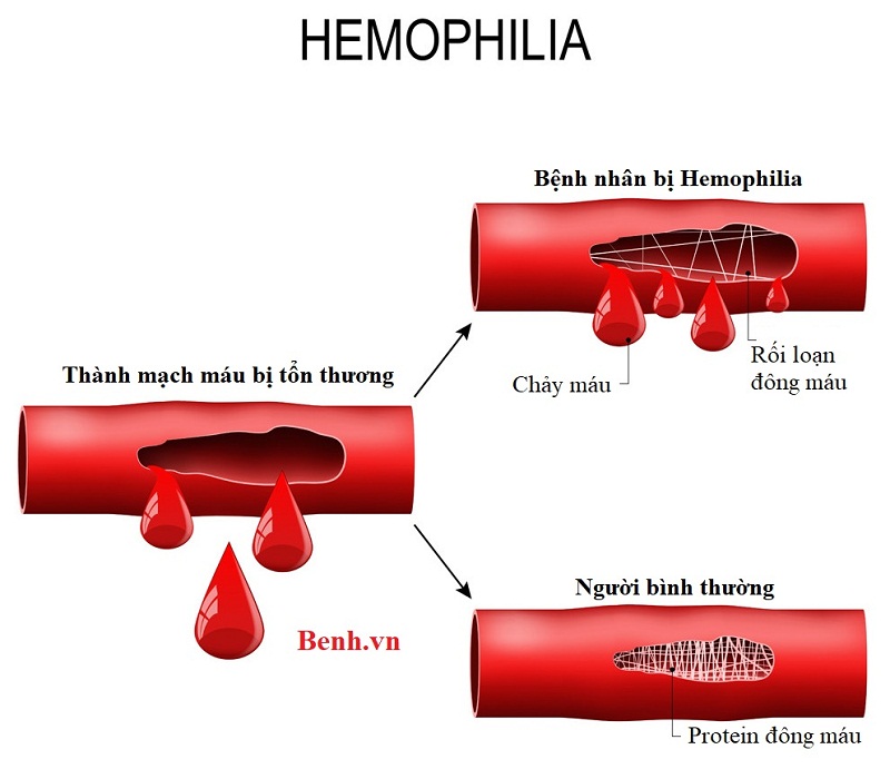 Chẩn đoán và xét nghiệm bệnh