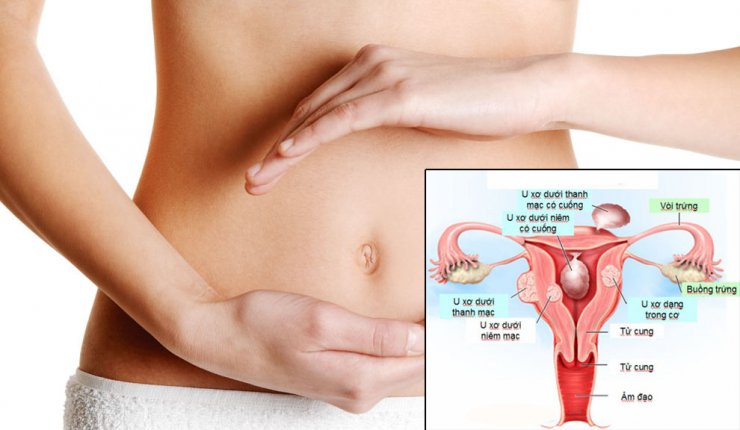 Tìm hiểu về chứng đau bụng dưới ở nữ và cách xử lý