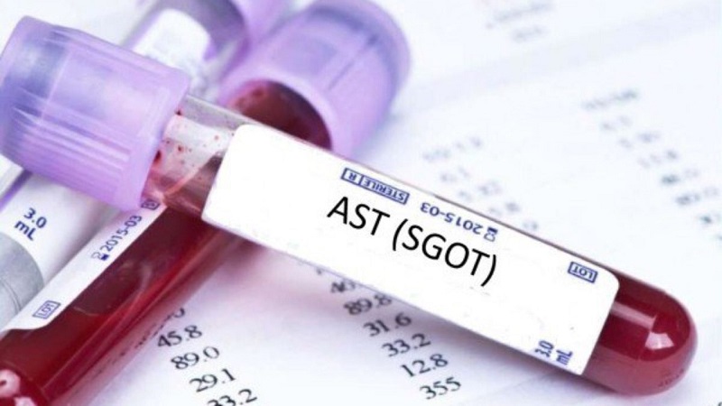 Tìm hiểu về xét nghiệm AST trong chẩn đoán các bệnh về gan