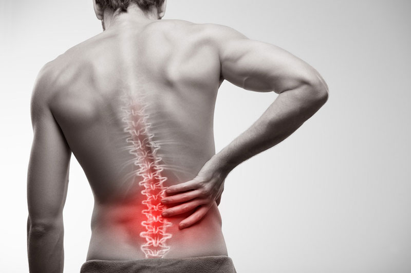 Tình trạng đau lưng dưới được chia thành 3 mức độ.