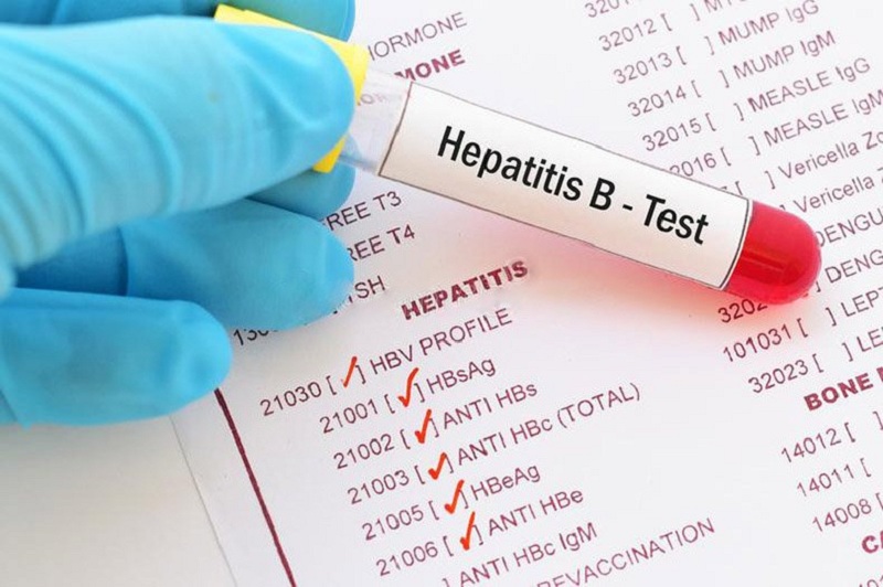Kết quả xét nghiệm HBsAb phản ánh điều gì về bệnh viêm gan B?