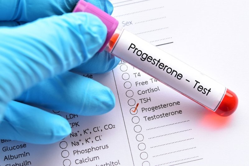 Kết quả xét nghiệm Progesterone phản ánh gì về sức khỏe sinh sản? | Medlatec