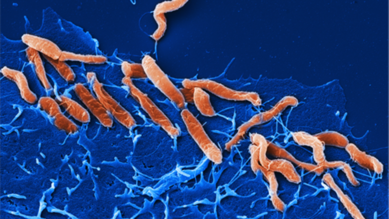 Vi khuẩn HP là gì và cần làm gì khi nhiễm vi khuẩn HP? | Medlatec