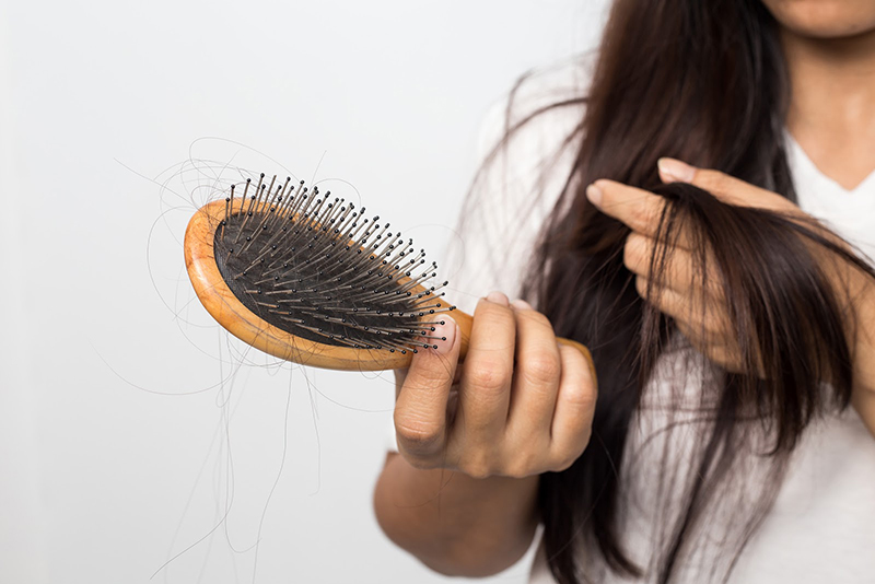 Bệnh tiến triển nặng gây rụng tóc nhiều và xuất hiện các mảng hói khiến người bệnh tự ti về vẻ bề ngoài