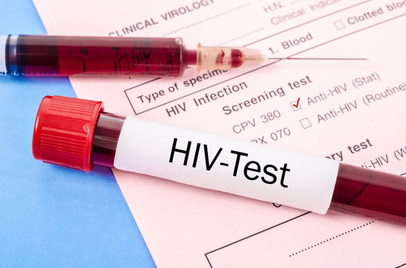 dấu hiệu nhiễm HIV sau 1 năm