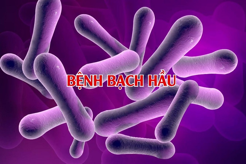 Hình ảnh 1: Vi khuẩn Corynebacterium diphtheria