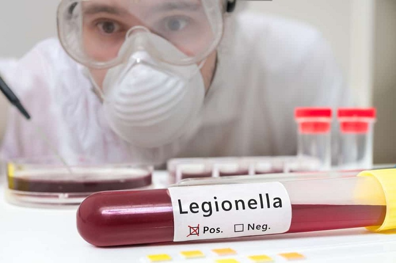 Xét nghiệm chẩn đoán nhiễm Legionella pneumophila