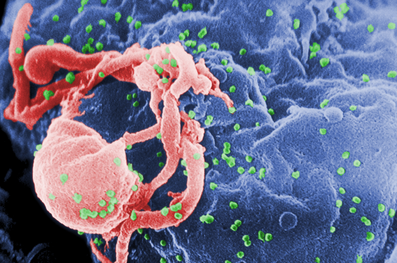 HLA cũng có liên quan đến nhiễm virus HIV