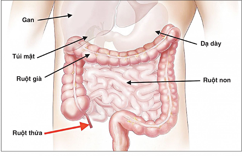 Thông tin về Đau âm ỉ quanh rốn