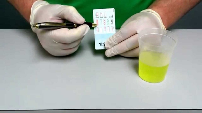 Xét nghiệm methamphetamine sử dụng test nhanh tổng hợp tìm 4 chất ma túy