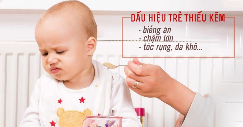 Các dấu hiệu của tình trạng thiếu kẽm