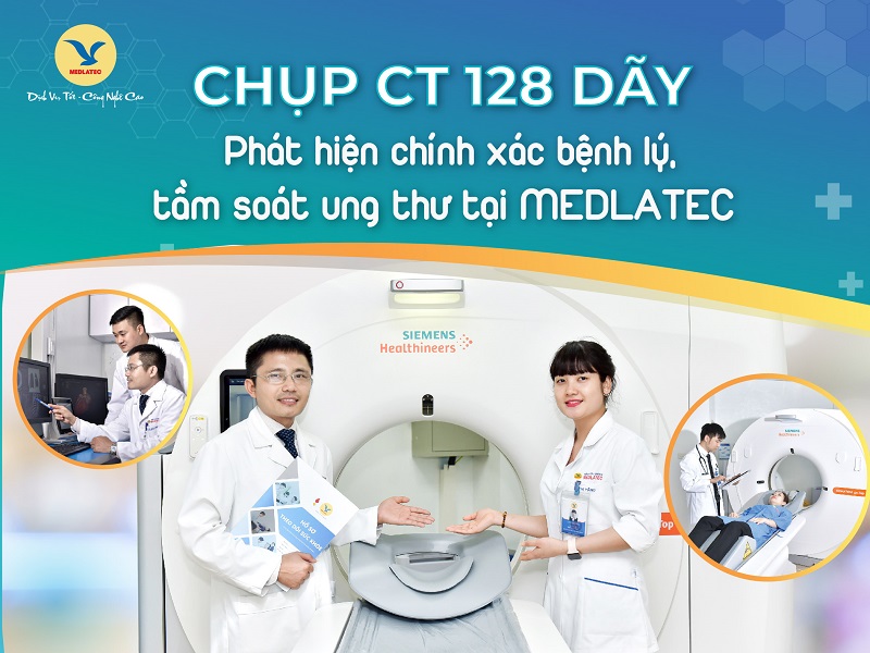 MEDLATEC - địa chỉ chụp CT đầu uy tín, chất lượng, giá cả hợp lý