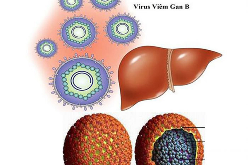 Bệnh viêm gan B cần được xét nghiệm và điều trị sớm để tránh những biến chứng nguy hiểm cho gan