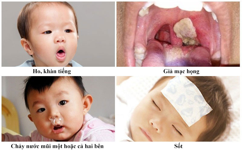 Vi khuẩn bạch hầu