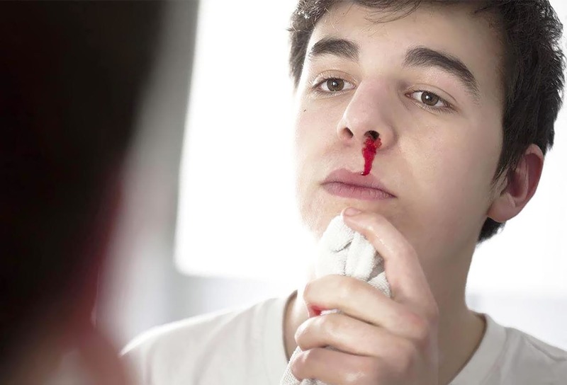 Chảy máu mũi trước thường có lượng ít nhưng có thể kéo dài 