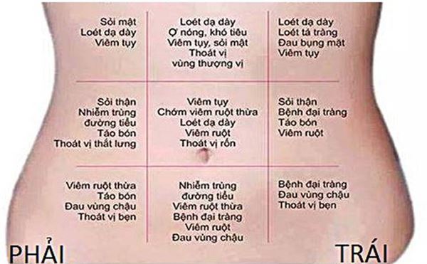 Đau hông bên trái ở nữ: Nguyên nhân và cách điều trị