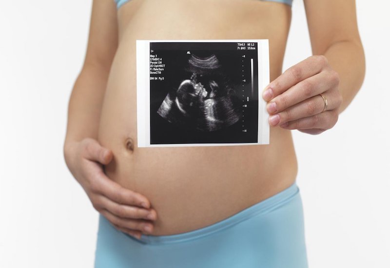 Thời điểm thai nhi được 4 tháng siêu âm có chính xác không?