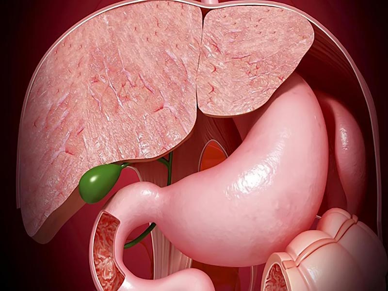 Polyp túi mật là căn bệnh lành tính thường gặp hiện nay