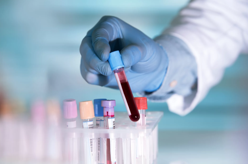 Đi xét nghiệm máu bệnh nhân cần lưu ý gì để kết quả chính xác? | Medlatec