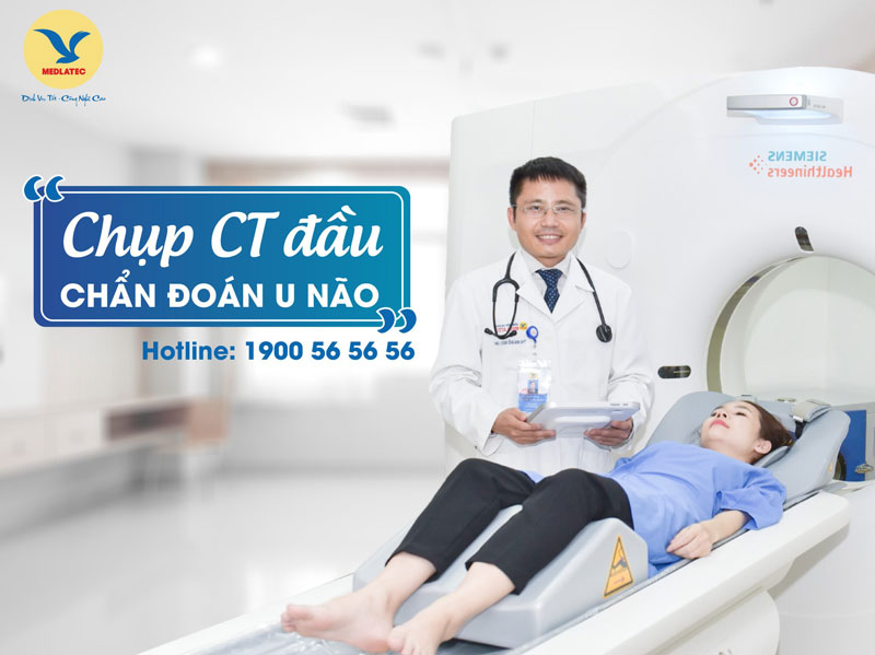 khám sức khoẻ medlatec