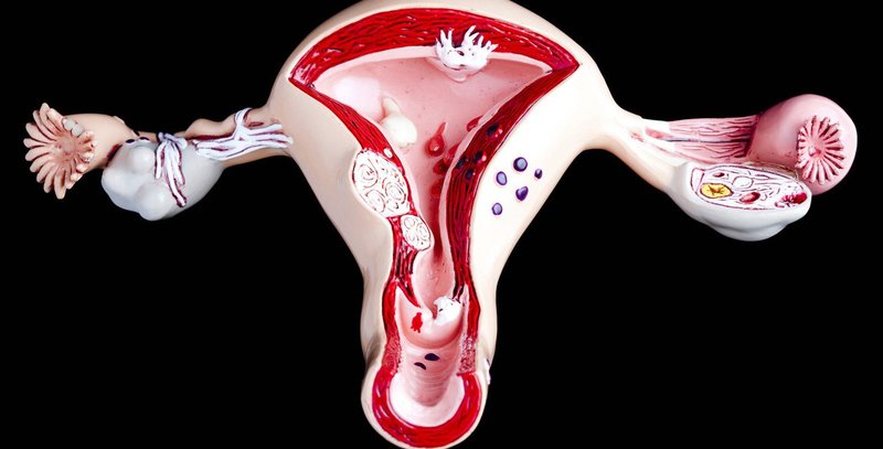 Nội mạc tử cung dày bao nhiêu là dễ thụ thai nhất?