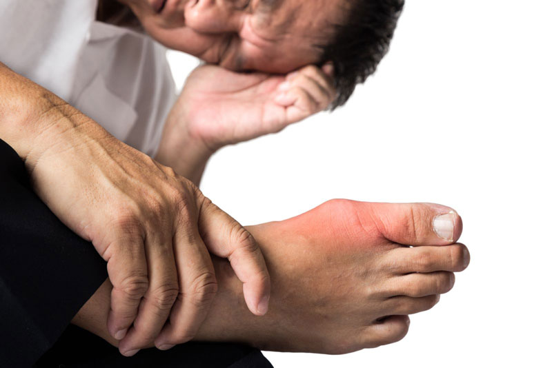 Bệnh gout rất có thể tạo ra nhiều biến tướng gian nguy cho những người bệnh
