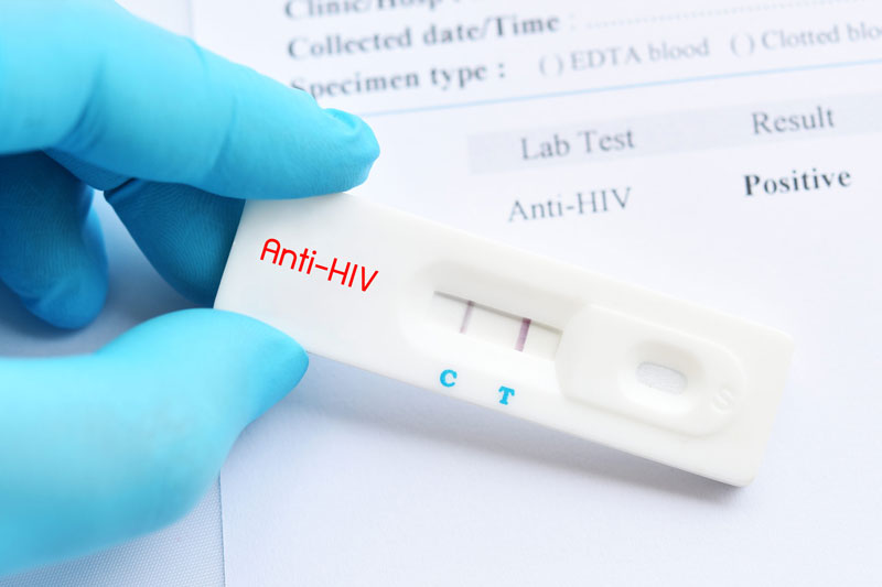 6. Quy trình xét nghiệm HIV