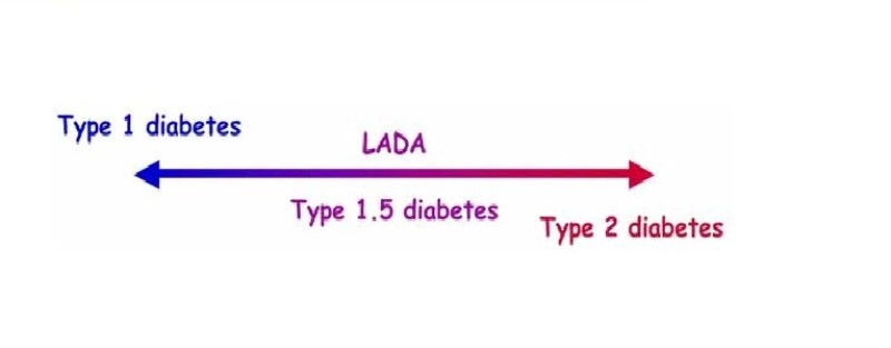 Hình 2: Vị trí của đái tháo đường type 1.5 so với type 1 và type 2