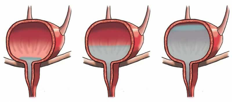 Chức năng dự trữ nước tiểu và đào thải nước tiểu thông qua niệu đạo 