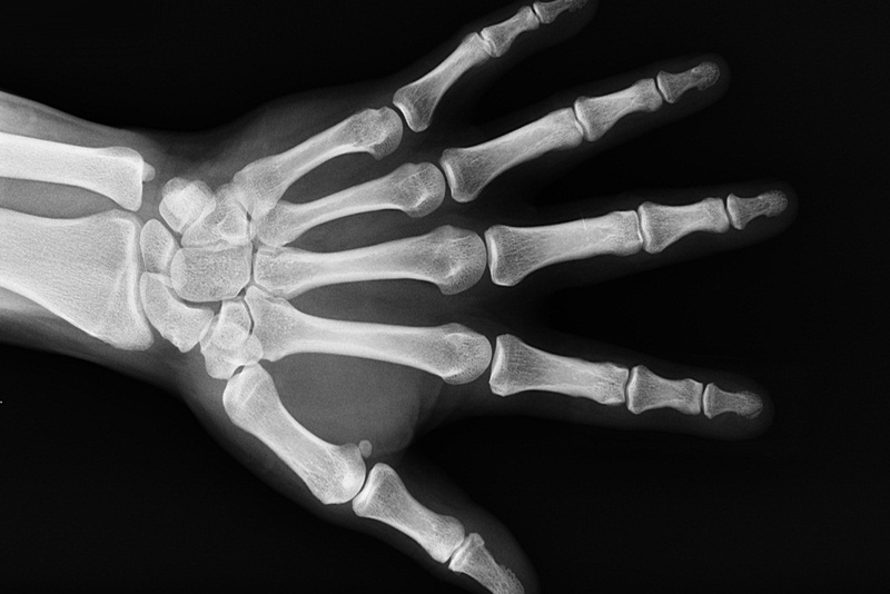Chụp X-quang là phương pháp chẩn đoán bệnh hiệu quả