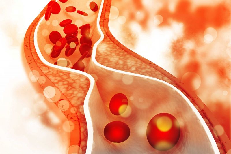 Phân loại cholesterol và nguyên nhân tăng cholesterol trong máu | Medlatec