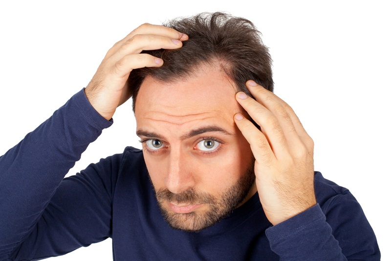 rụng tóc nhiều ở nam có thể do suy giảm nội tiết tố