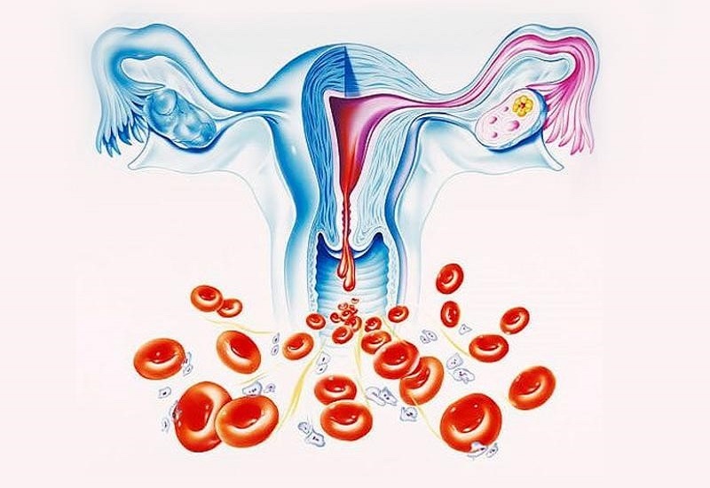 Đối tượng bị rong kinh thực thể cần được điều trị nhanh chóng kịp thời