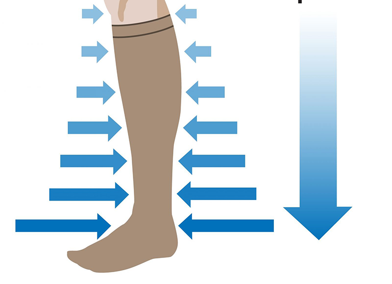 Tất y khoa sẽ tạo ra áp lực ở chân nhằm cải thiện biểu hiện suy giãn tĩnh mạch
