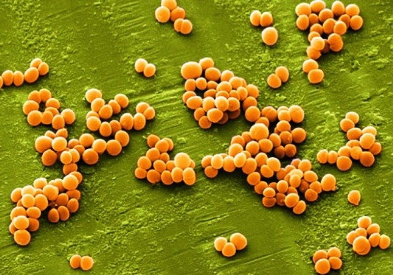 Vi khuẩn tụ cầu vàng trong thực phẩm có thể gây ngộ độc thức ăn cho con người