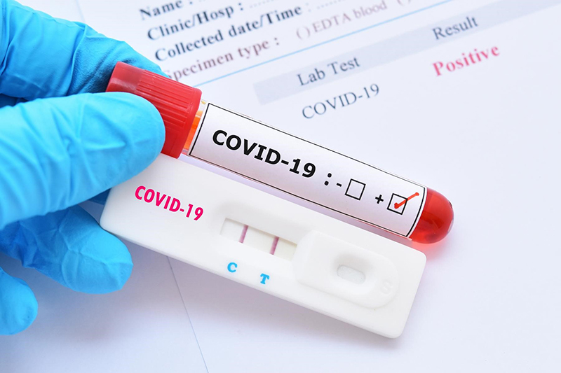 Xét nghiệm Covid-19 bao nhiêu tiền nhằm phát hiện virus SARS-CoV-2