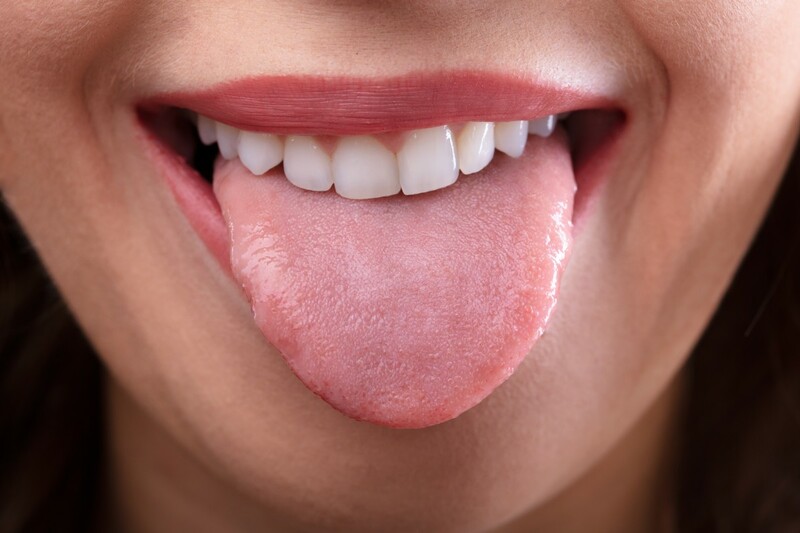 Tình trạng sưng lưỡi sẽ được cải thiện khi cung cấp đủ Vitamin B12