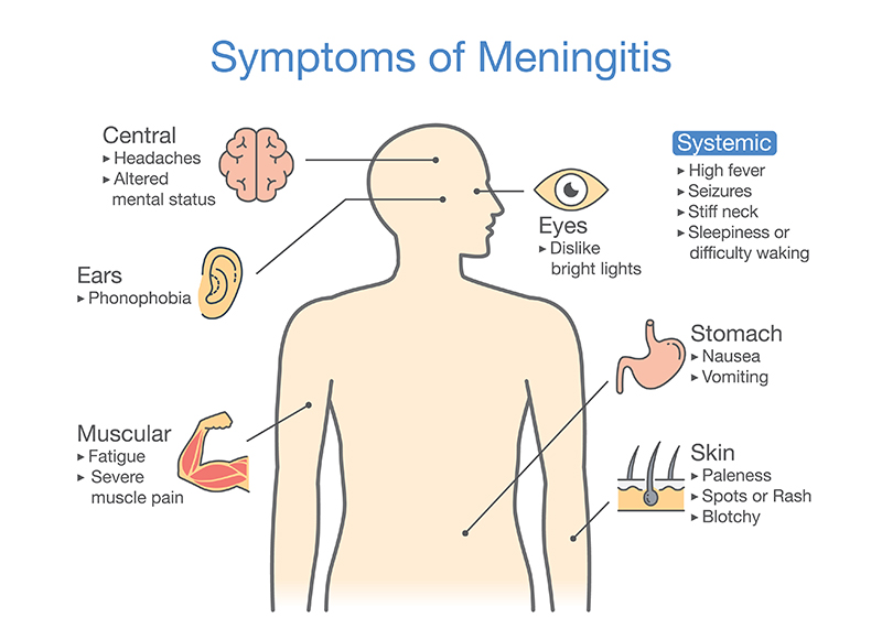 Nhiều cơ quan trên cơ thể bị tác động khi người lớn mắc bệnh viêm màng não