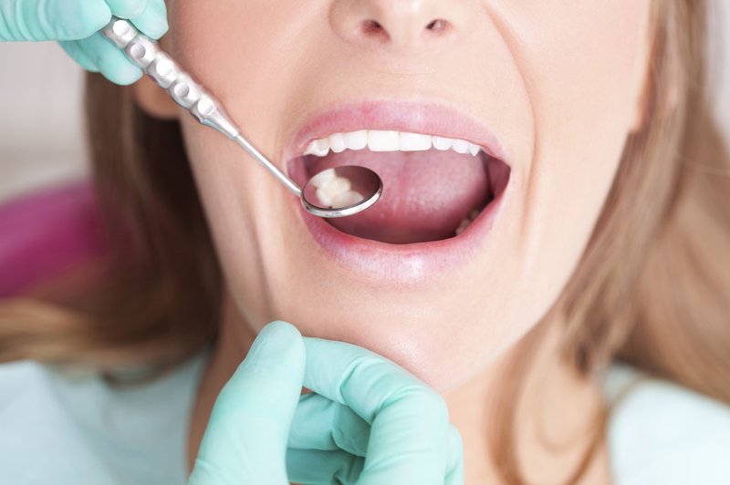 Chăm sóc răng miệng tốt giúp phòng ngừa áp xe răng tái phát