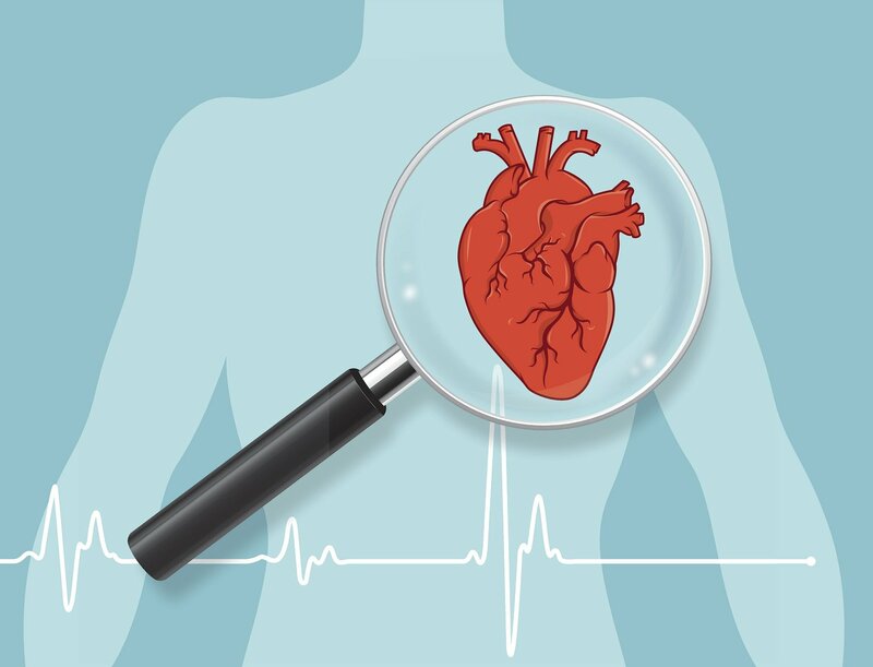 Thiếu máu cục bộ cơ tim có thể dẫn đến nhồi máu cơ tim nguy hiểm