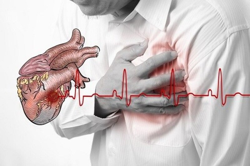 Nguyên nhân nhồi máu cơ tim và dấu hiệu nhận biết điển hình | Medlatec