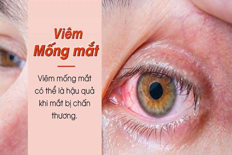 4. Biến chứng có thể xảy ra