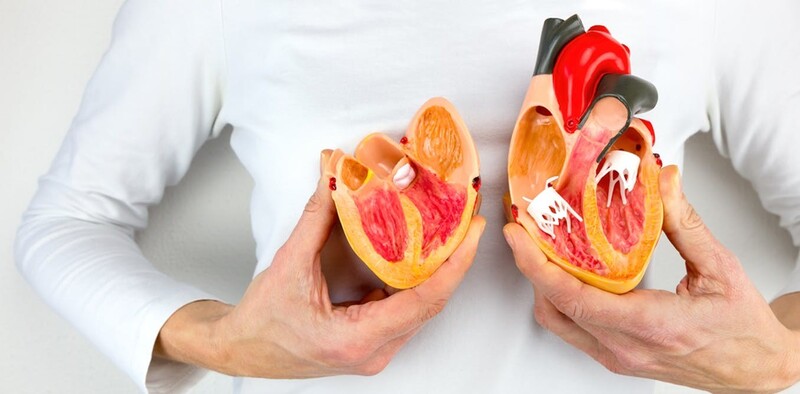 Nhận biết sớm suy tim ở bệnh nhân cao huyết áp từ 5 dấu hiệu FACES