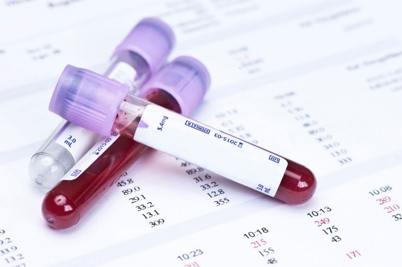 Xét nghiệm máu giúp chẩn đoán chính xác có thai hay không