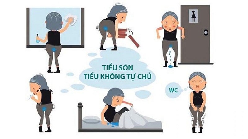 Các triệu chứng điển hình của bệnh rối loạn co thắt cơ trơn bàng quang